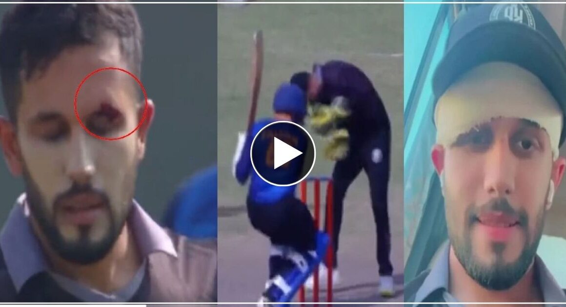 पाकिस्तानी खिलाड़ी को भारी पड़ गया होशियारी दिखाना, मैच में हो गया बड़ा हादसा, आंखें फूटने से बची video